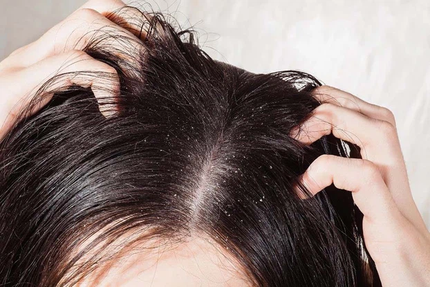 Brown U tip hair extension Brown U tip hair extension